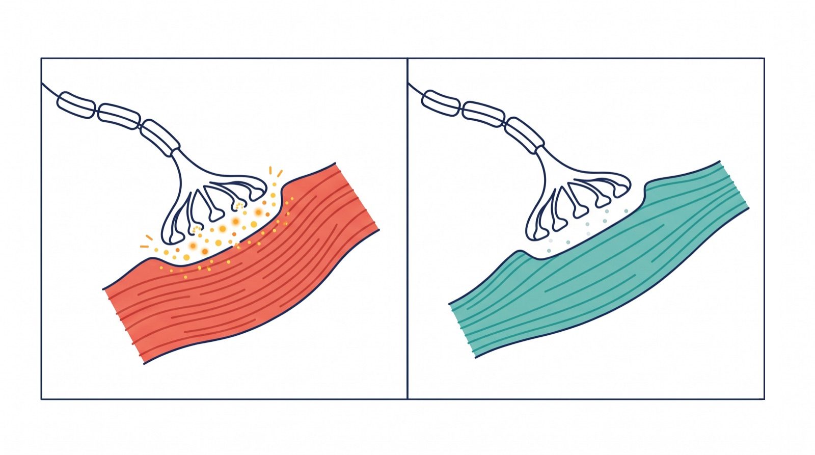 Two-panel diagram: on the left, many signal particles cross from a nerve ending to a tightly contracted red muscle; on the right, only a few particles cross and the muscle is relaxed and teal