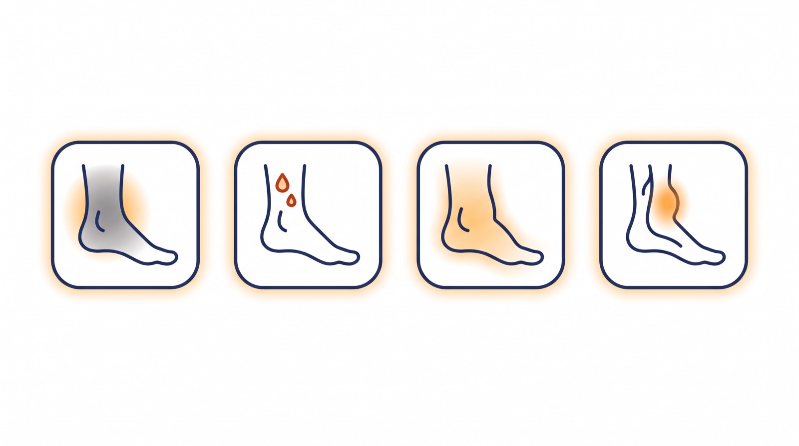Icons of the four ankle warning signs: skin darkening, bleeding, swelling, and a tender lump