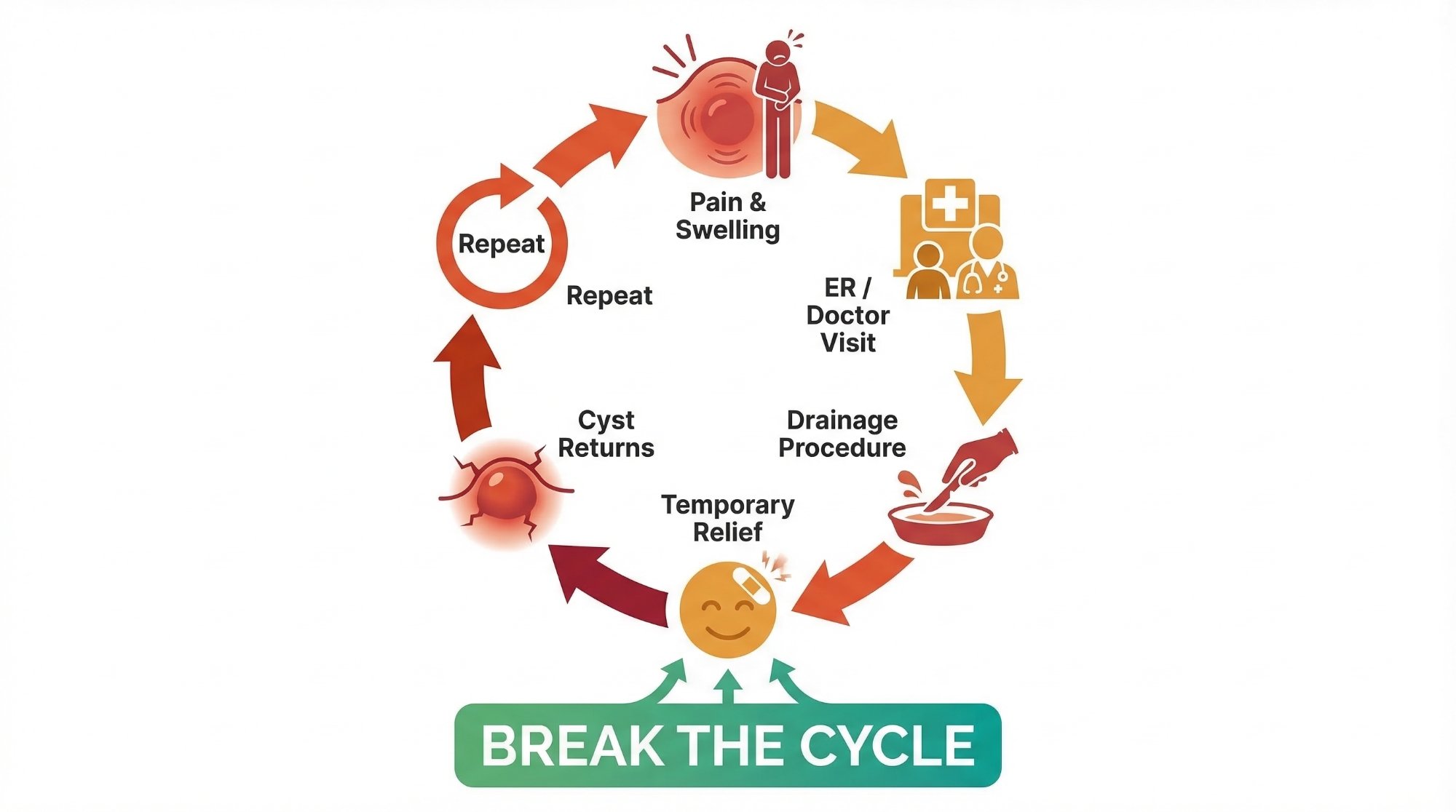 The cycle of failed pilonidal treatment: Pain and Swelling, ER Visit, Drainage, Temporary Relief, Cyst Returns, Repeat. Break the Cycle